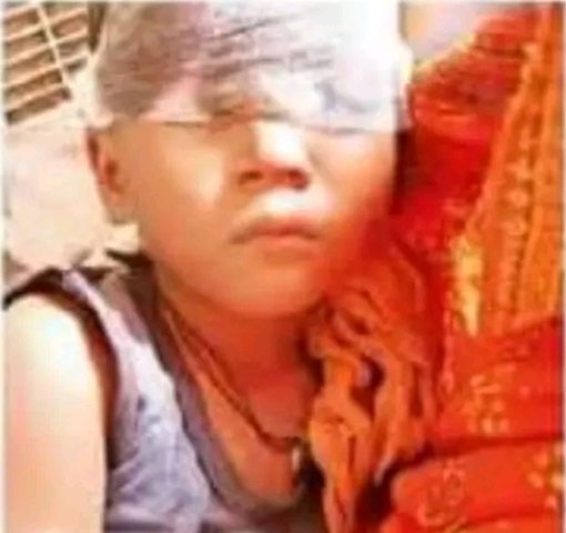 बोकारो के कसमार प्रखंड में सियार के हमले के बाद ग्रामीण और घायल लोगों का दृश्य